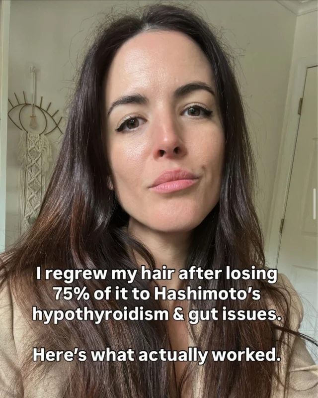 👉Comment CHEAT SHEET for my internal Hashimoto’s healing doc.

I regrew my hair after losing 75% of it to Hashimoto’s hypothyroidism and gut issues.

It took me 6 years and a lot of trial and error to figure out what actually worked…and it wasn’t another elimination diet.

I put the exact framework into a free cheat sheet. It’s what we use with every Hashimoto’s client in our practice.
Inside you’ll get:

→ The full thyroid lab panel your doctor probably isn’t running (with optimal ranges)
→ The 4-pillar root cause framework to actually get into remission
→ 10 Hashimoto’s superpower foods and why they work
→ The morning protocol to start this week

Download it free — click link or comment “CHEAT SHEET”🦋