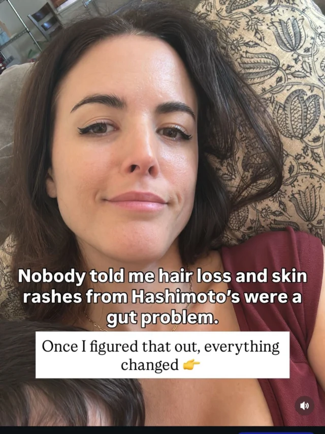 👉Comment AUDIT for the link to save your spot for the LIVE 45-min. Thyroid-Gut Audit this Fri. 4/10🦋

Swipe to see the thyroid-gut loop that keeps most women stuck no matter how clean they eat or how many supplements they take.

This is exactly what we’re breaking down LIVE on Friday April 10th at 12pm ET — the free 45-min. Thyroid-Gut Audit.

No replay. Live only. 

👉Comment AUDIT below and I’ll send you the link to save your spot. 👇

#hashimotos #thyroidhealth #guthealing #hashimotosremission #hypothyroid