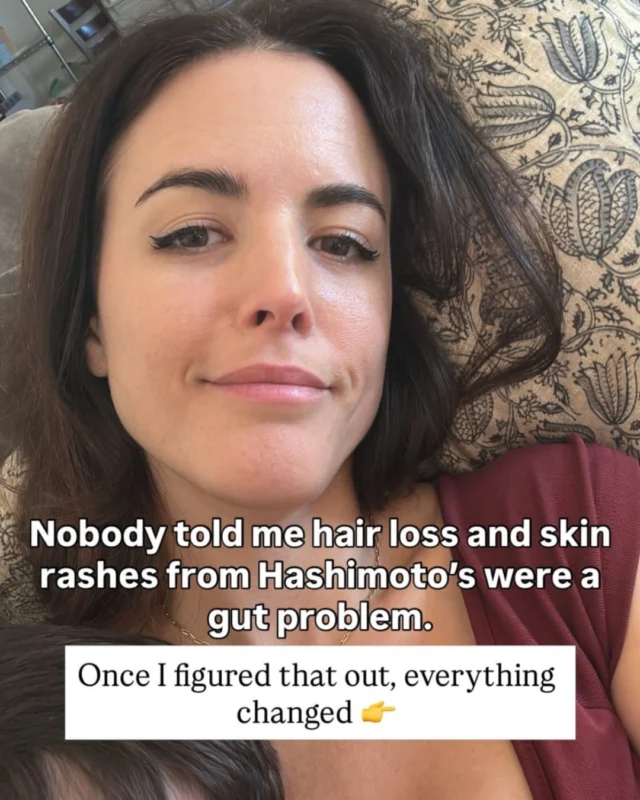 👉 Comment “AUDIT” for the link to save your spot for the LIVE Thyroid-Gut Audit on Tues., May 12th!!

Spots are limited and it’s FREE.

Bring your labs if you got them and your questions, we will audit what’s happening with you for more clarity. No more DIY duct taping drama. 

🦋 #hashimotos #hypothyroid #pcos #aipdiet #autoimmunedisease