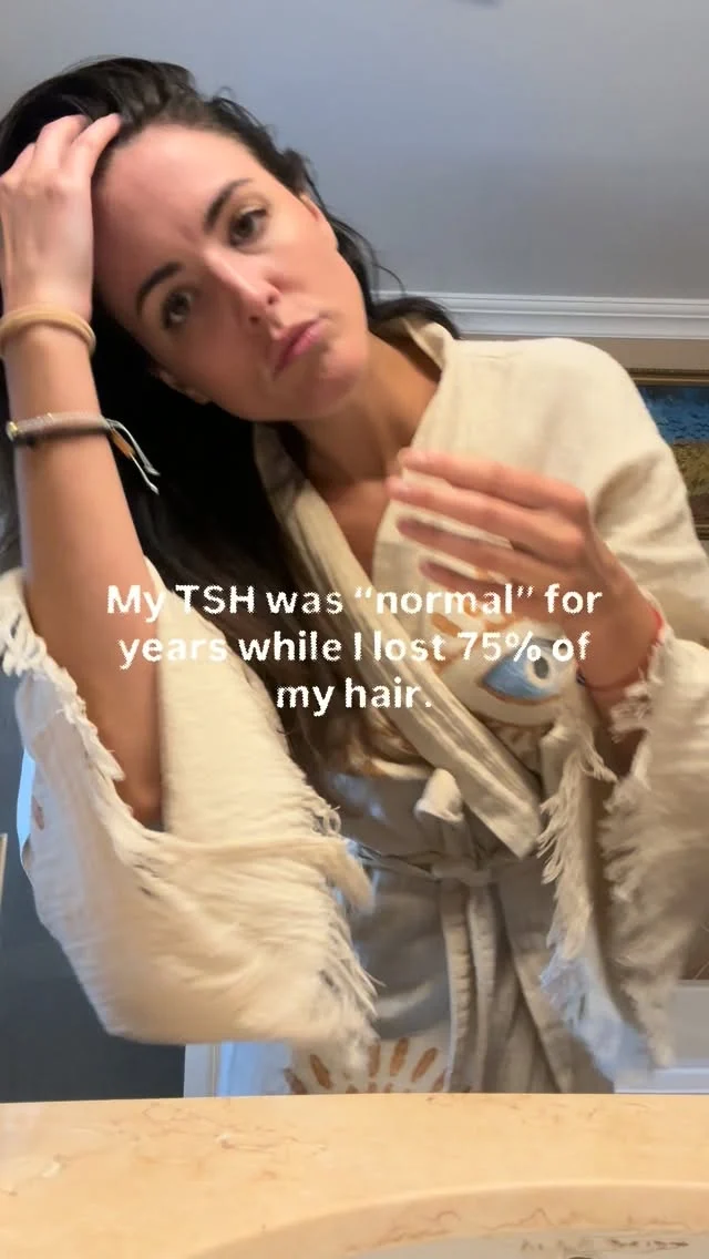 Tell me if any of these sound familiar?

🚩Symptoms: Rapid Hair Loss, Thinning, Dryness

👉The missed underlying issues:
- Nutrient absorption issues (I could eat as healthy as I wanted but couldn’t absorb nutrients)
+ Low Iron AND ferritin (ferritin - 70 is optimal, I was a 10)
+ Low vitamin D (this looked “normal” but needed to be around 80... I was around 25)
& Hypothyroidism- had they checked ALL markers and not just TSH and T4, they’d have seen my T3 was in the gutter and my TPO antibodies were over 300

🚩Symptoms: Puffy face, Woke up exhausted and crashed daily by 2pm, Running on coffee, Wired at night, Painful, heavy periods and ovarian cysts

👉The missed underlying issues:
-Estrogen dominance and stuck detox pathways (so yeah, PCOS)
-Cortisol and adrenal imbalances, I was fried & Blood sugar dysregulation

🚩Symptoms: daily bloat that worsened as day went on, joint pain, food sensitivities and skin reactions, brain fog, chronic constipation

The missed underlying issues:
-Methane dominant SIBO
-Leaky gut
-2 Parasites
-Strep, Staph and other bacterial overgrowths
-Gut-brain/NS dysregulation

After healing my root causes...
PMOS, SIBO, gut infections, and Hashimoto’s went into remission (for the last 8 years) and I had 2 babies.

🙏Today, even while I’m amidst a Hashi flare... I know *exactly what to do so my body can heal.

👉Get my 10-page FREE Hashimotos Healing Cheatsheet so you know what to do, too… just comment “CHEATSHEET” below.

#hashimotos #autoimmunedisease #foodsensitivities #hypothyroid #pmos